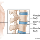 Illustration for article titled Your synthetic spine is (almost) ready